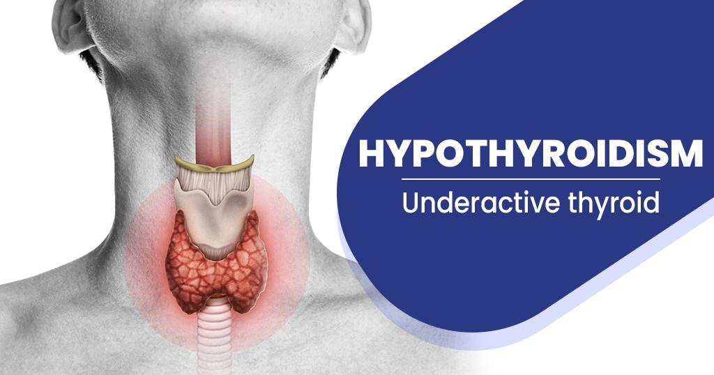 Hypothyroidism